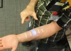 Skinput System used on arm with arm band